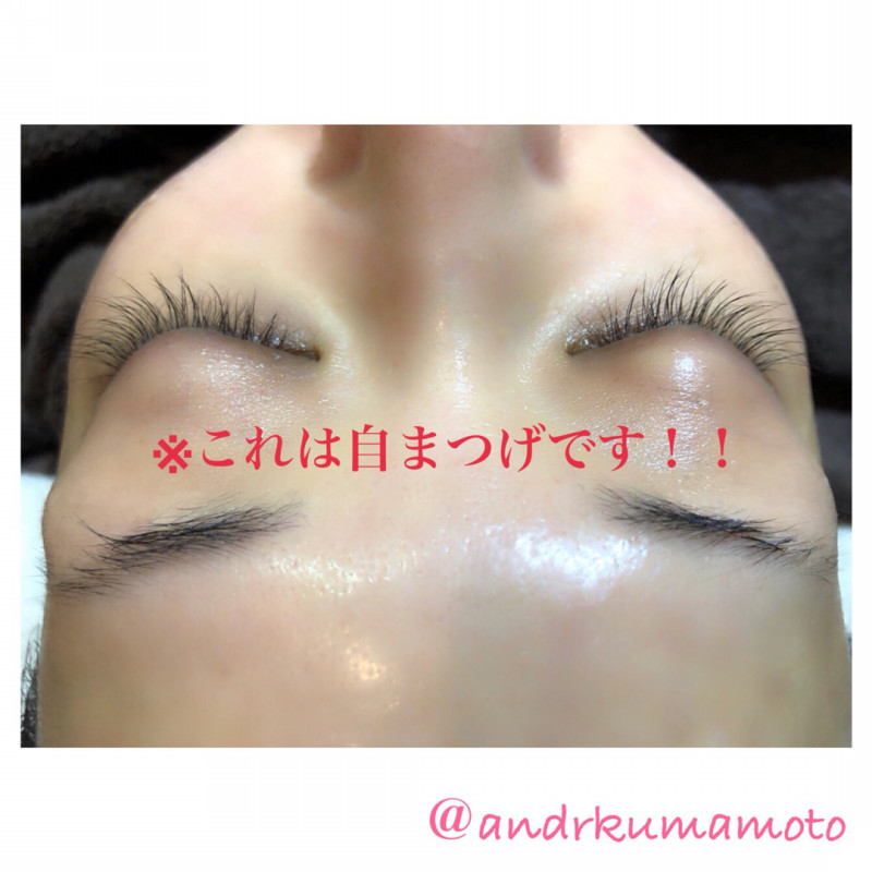 アンドアール