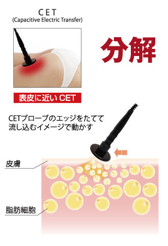 アンドアール