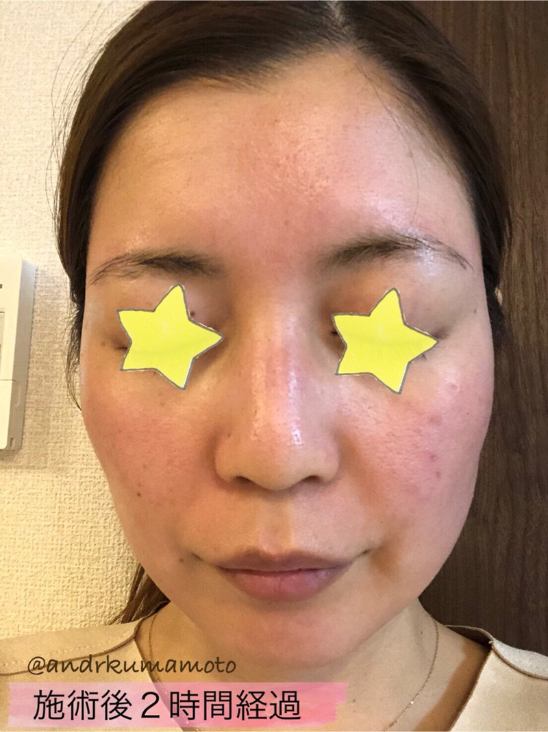 アンドアール