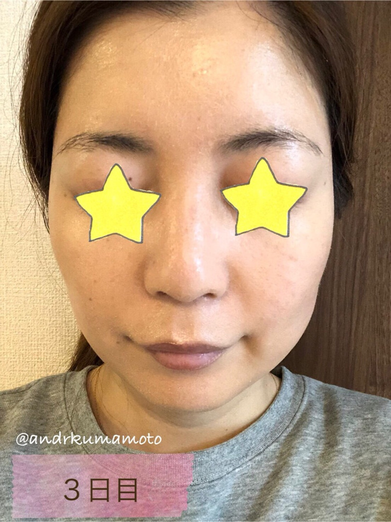 アンドアール