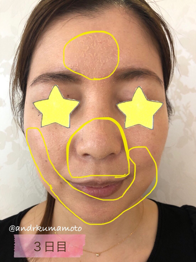 アンドアール