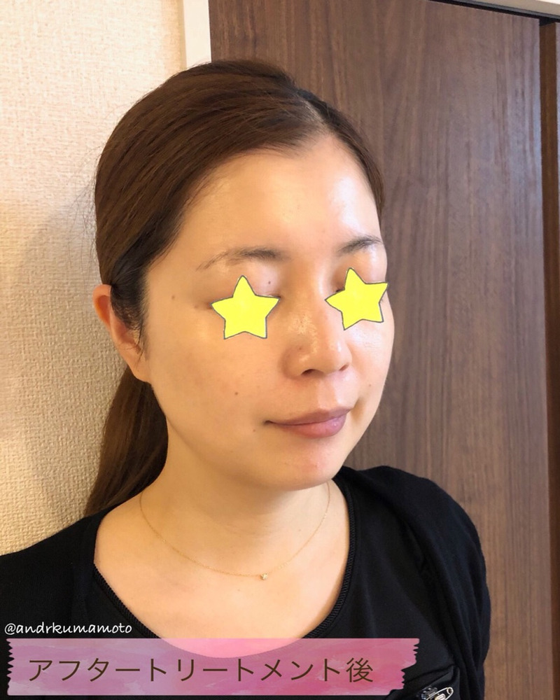 アンドアール