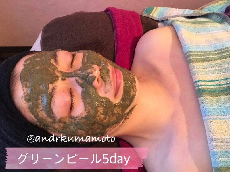 アンドアール