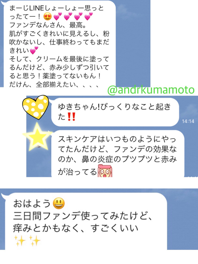アンドアール