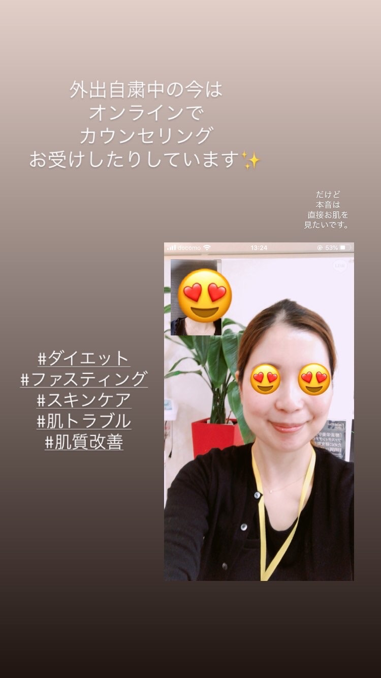 アンドアール