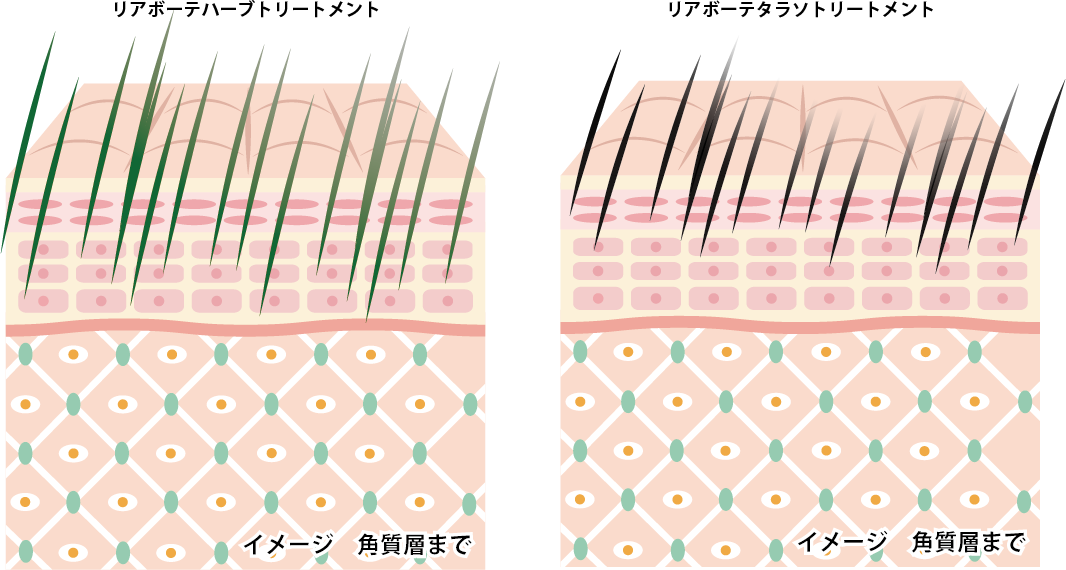 アンドアール