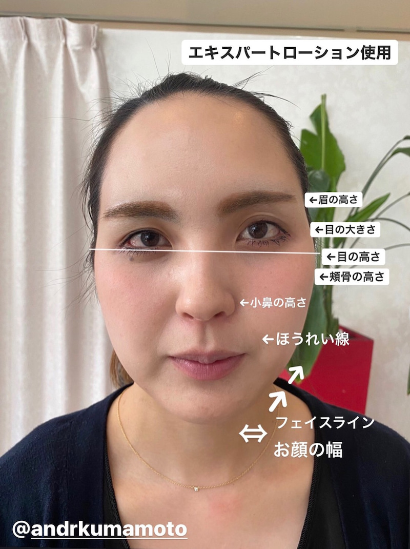 アンドアール
