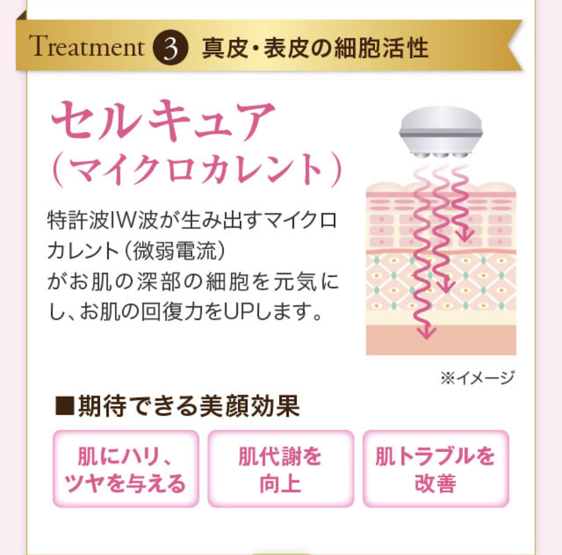 アンドアール