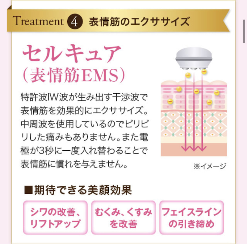 アンドアール