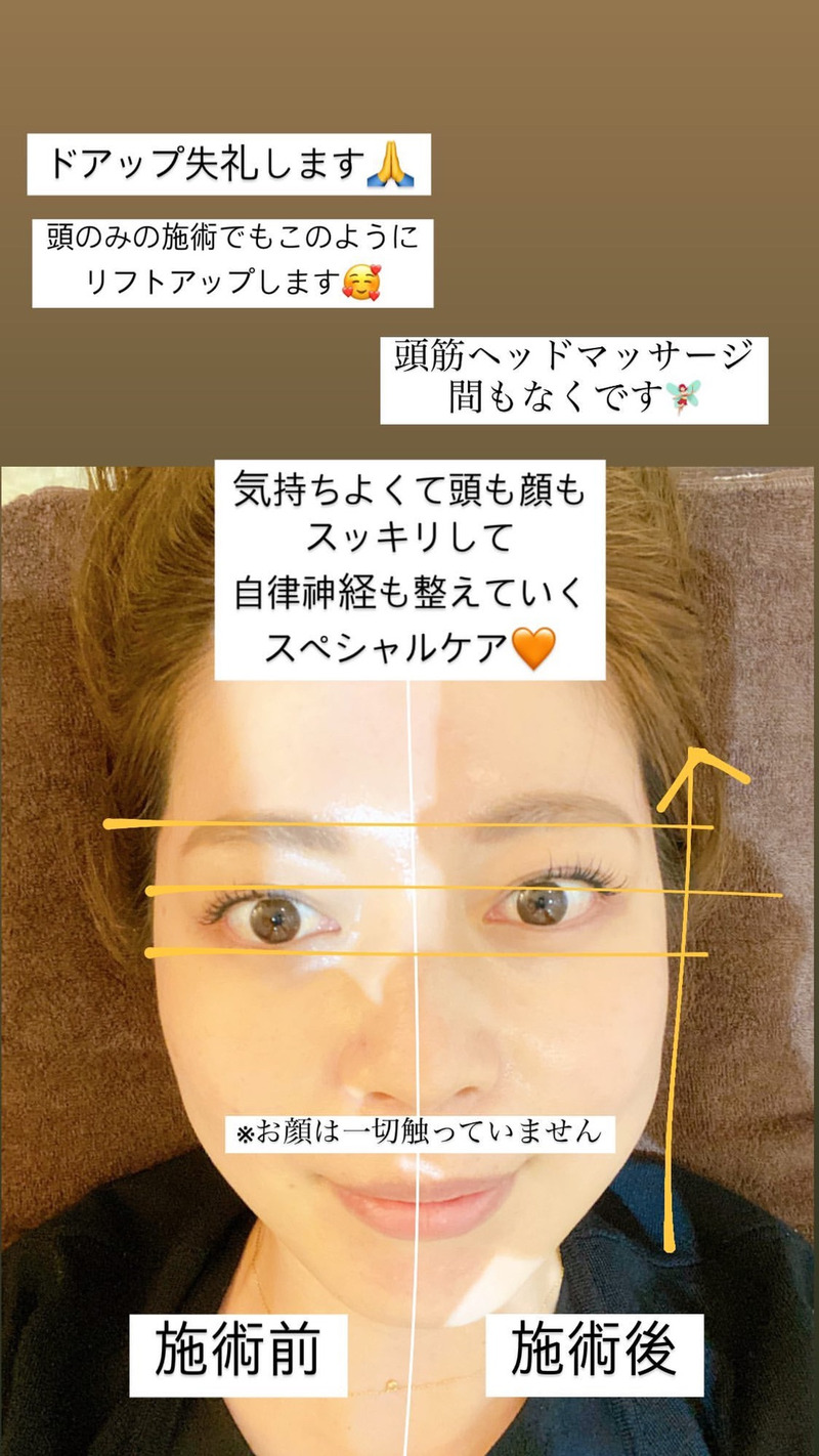 アンドアール