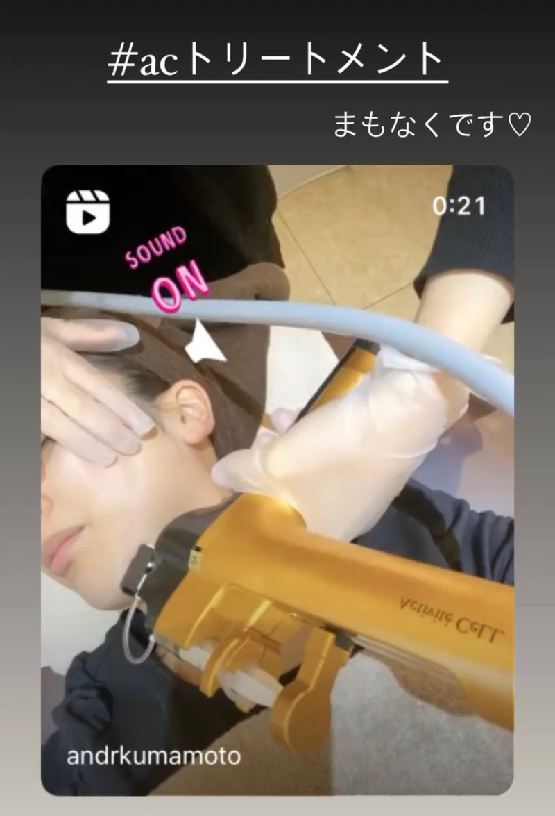 アンドアール