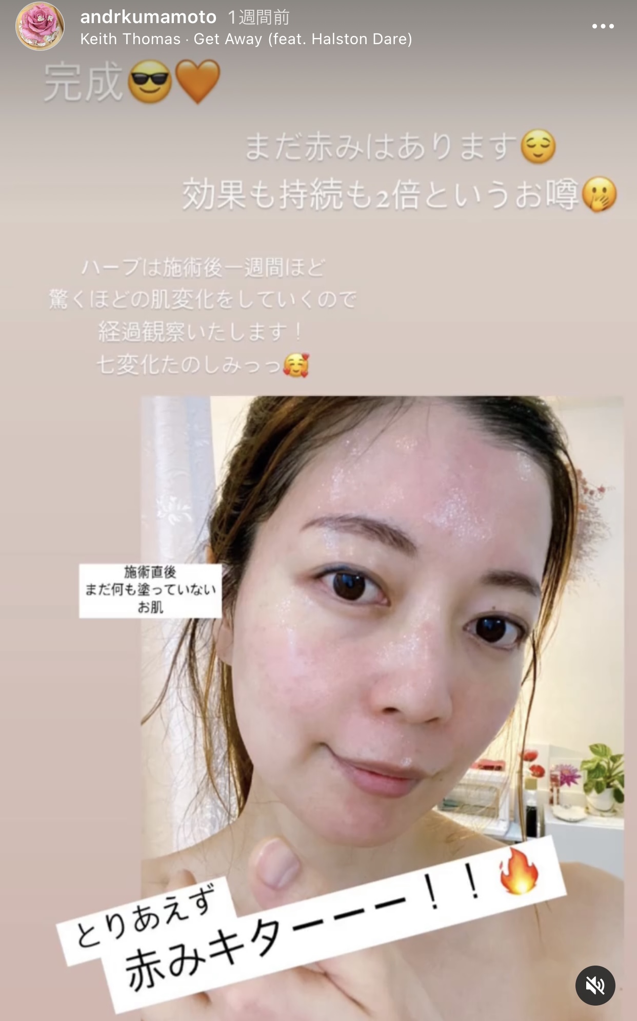 アンドアール