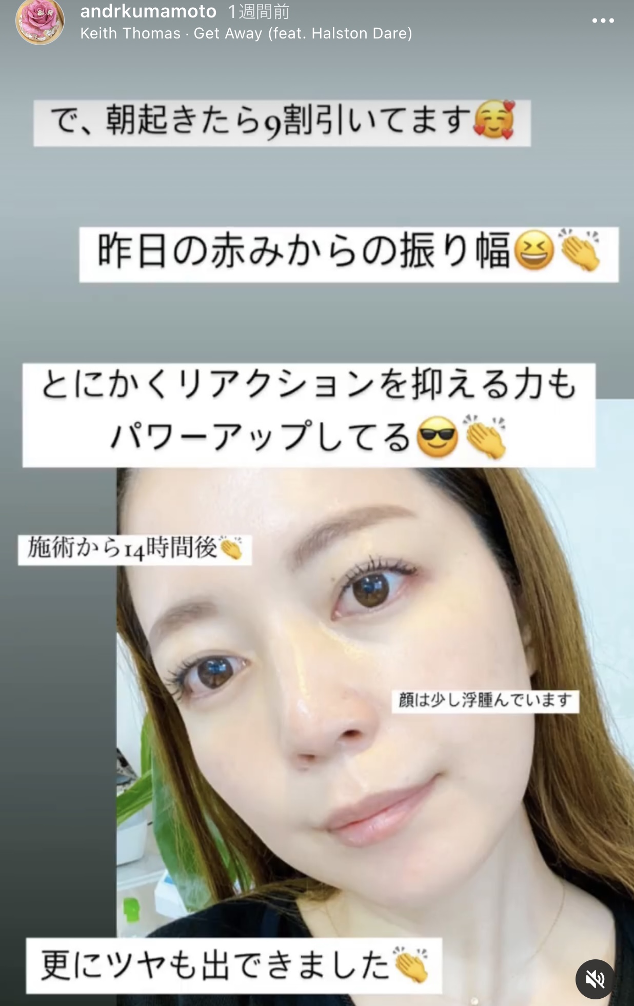 アンドアール
