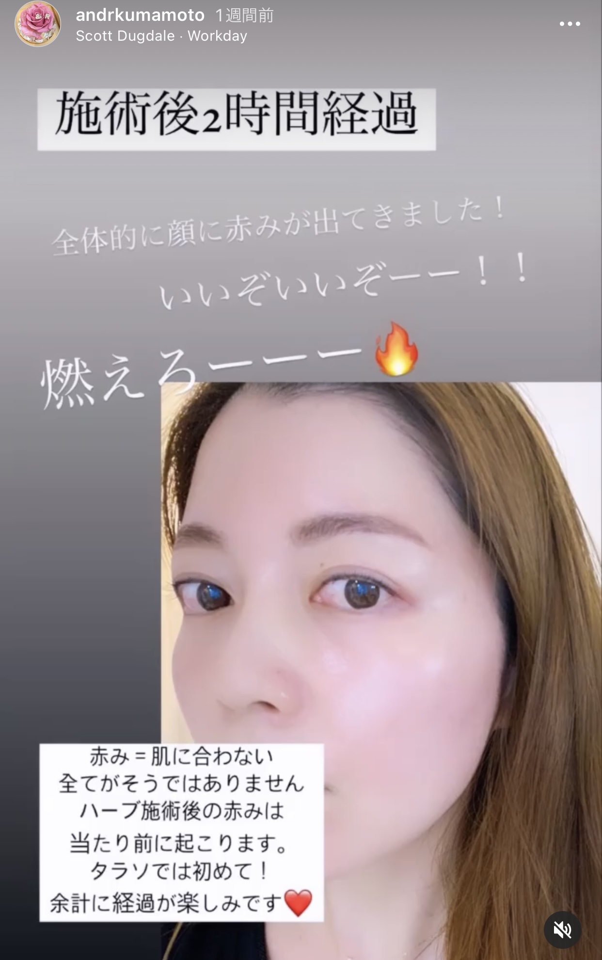 アンドアール