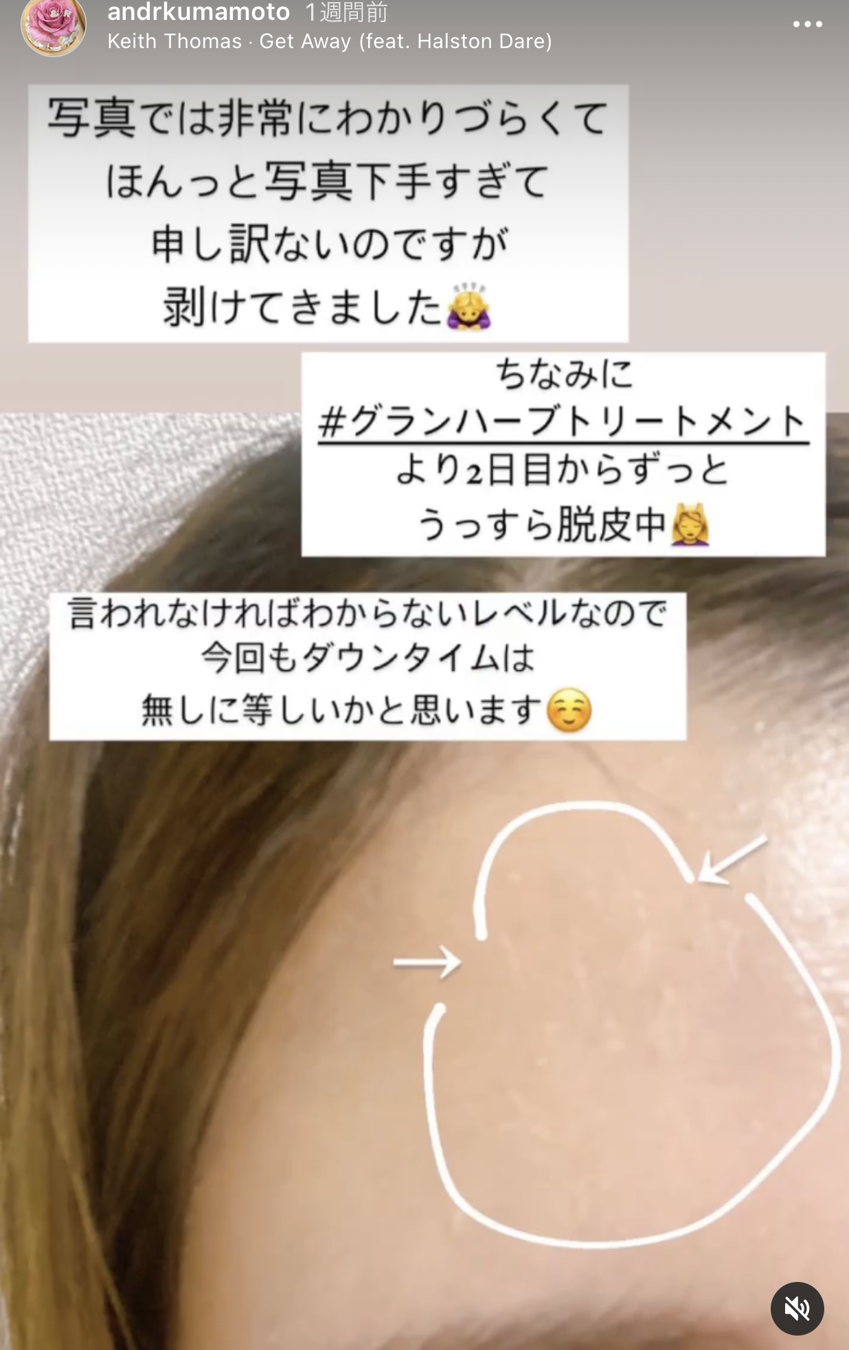 アンドアール