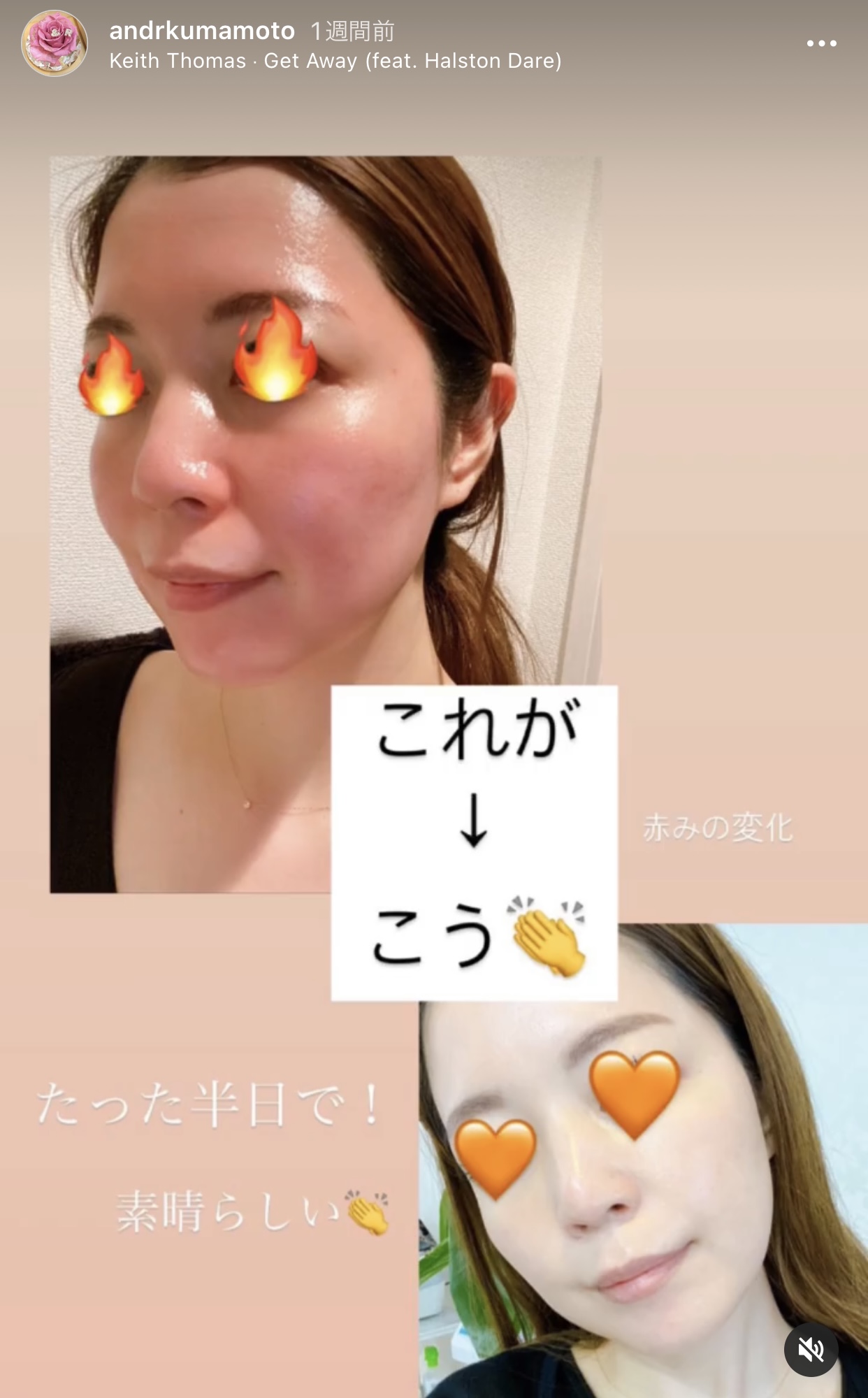 アンドアール