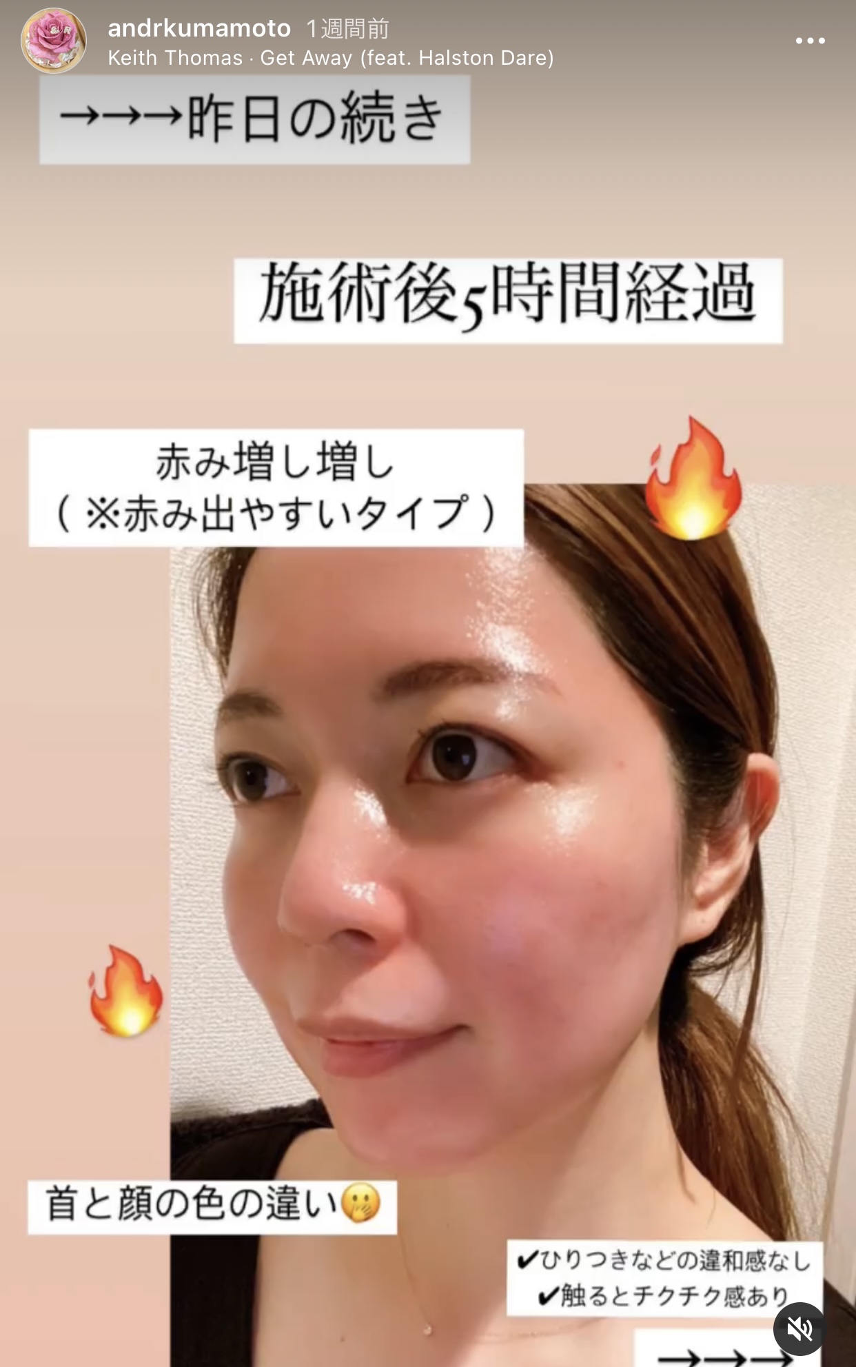 アンドアール